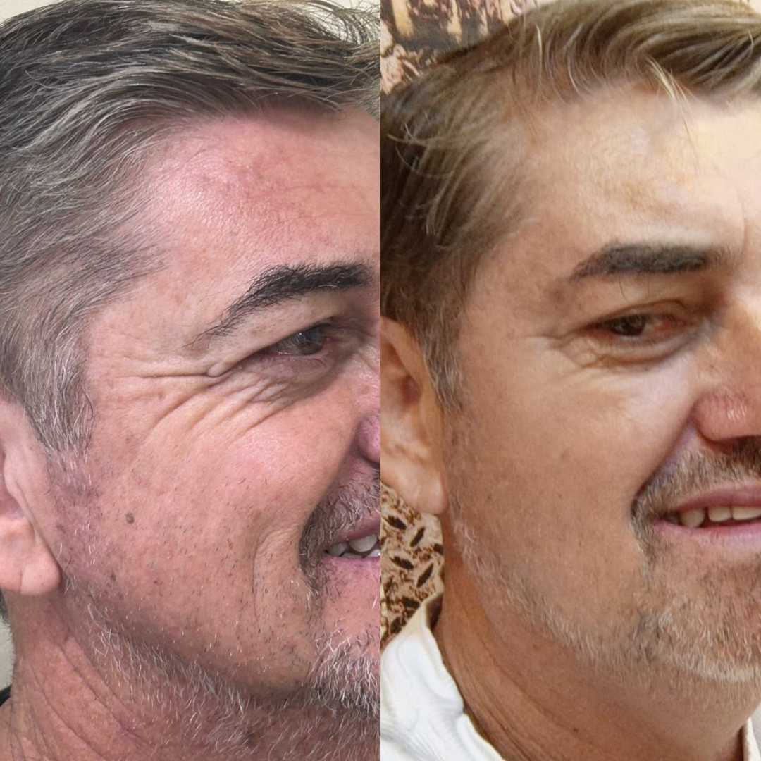 7.png